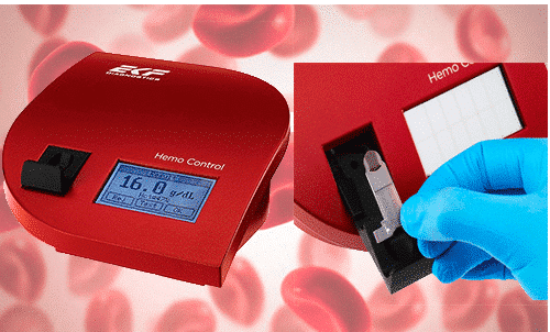 Analisador de sangue HemoControl