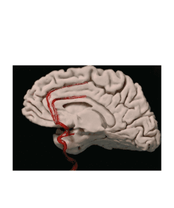 Arteries Arterias cerebrales impresas en 3D